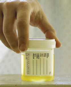 hydrogen-peroxide-urine-drug-test