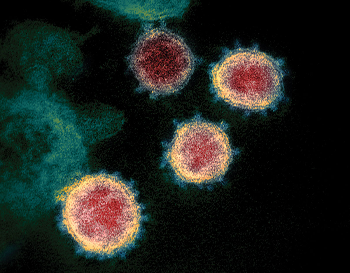 What do we know about the novel coronavirus’s 29 proteins?