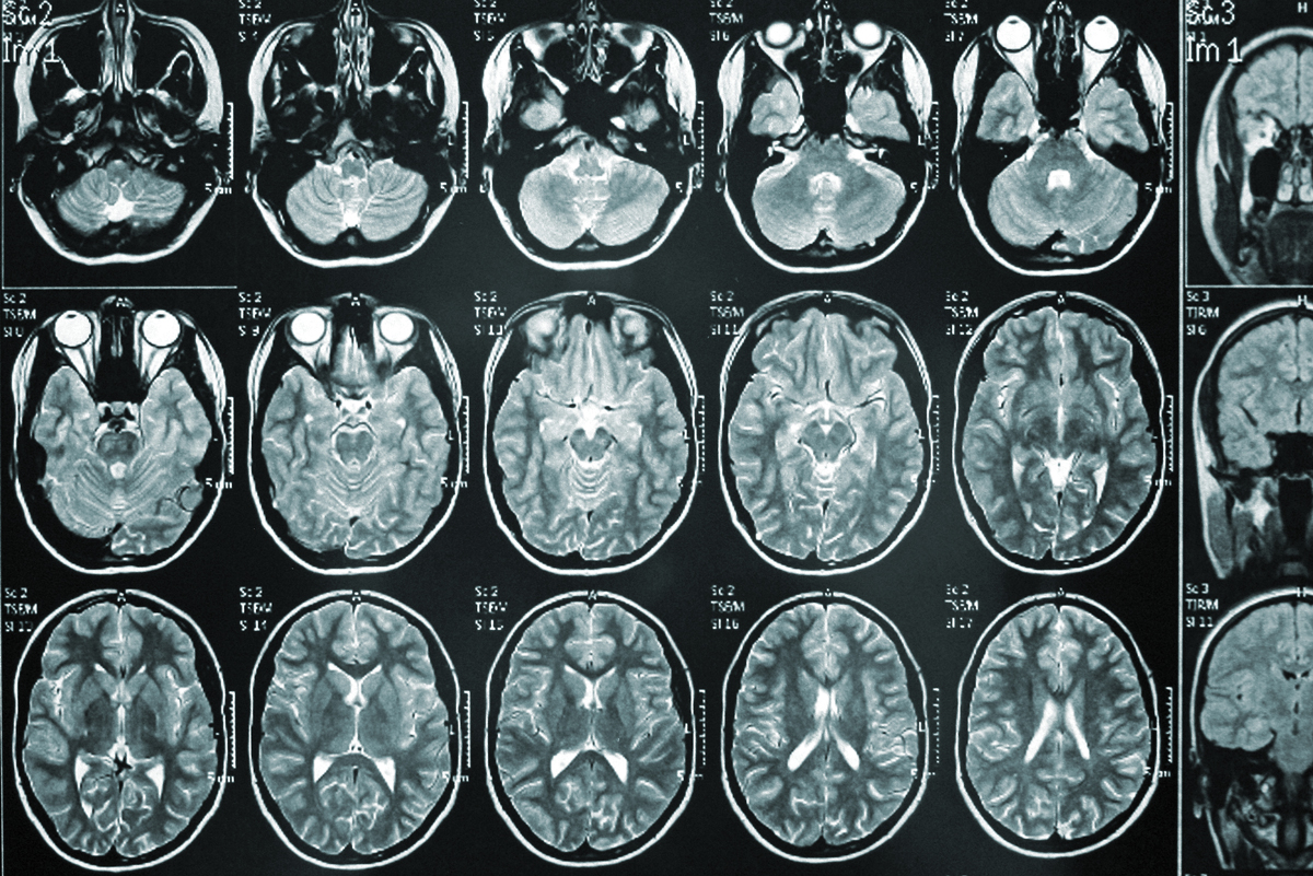 Images of top-view brain scans