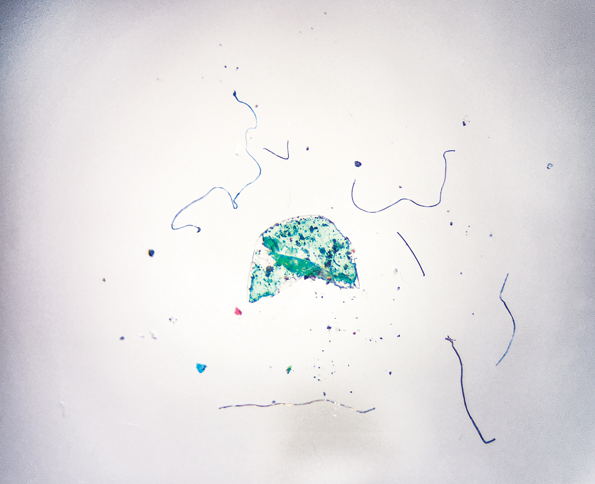 Microscopy image showing gold, blue, and black fibers, a green blob flecked with black, and other multicolored particles against a white background.
