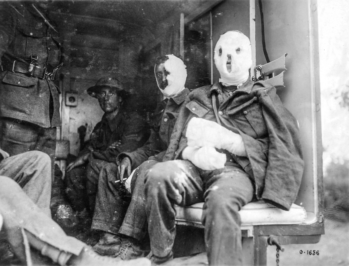 Mustard gas victims with bandaged faces await transport.