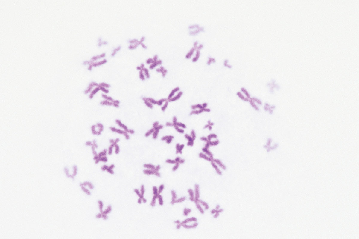Micrograph of human chromosomes.